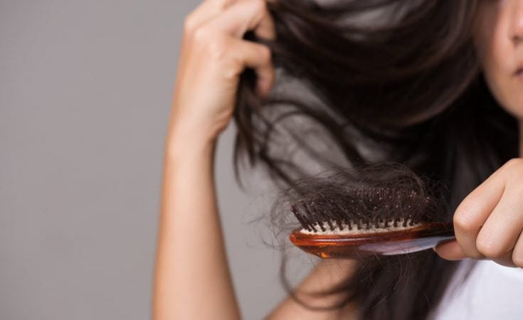 hair loss facelift